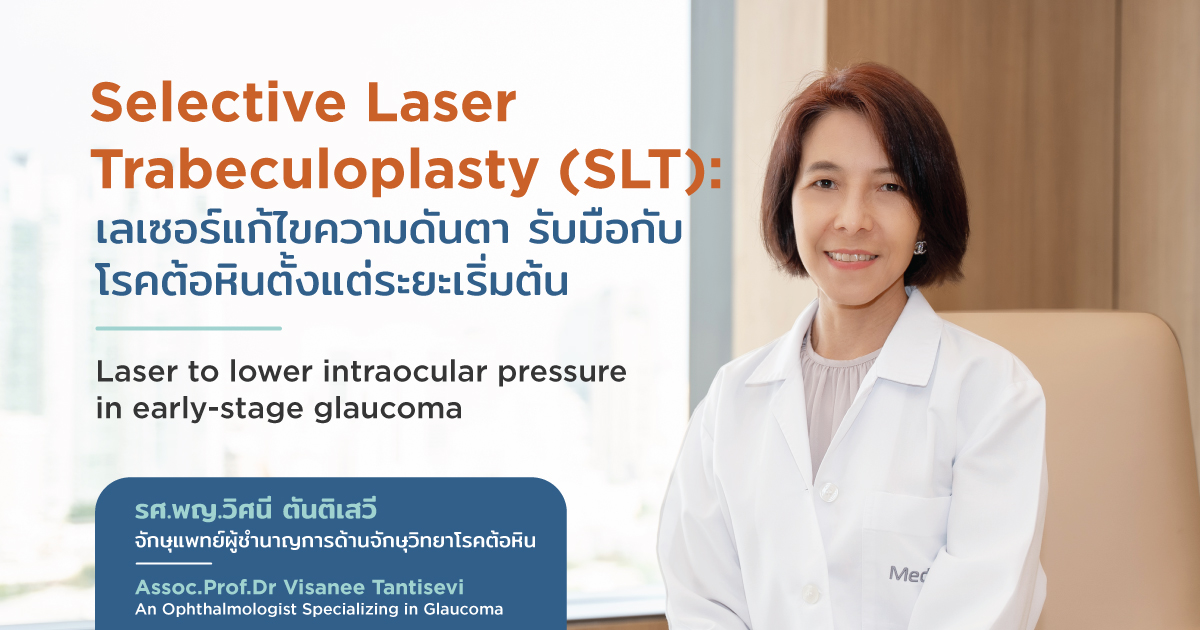 เลเซอร์แก้ไขความดันตา (SLT) รักษาต้อหินตั้งแต่ระยะเริ่มต้น - Selective Laser Trabeculoplasty (SLT)