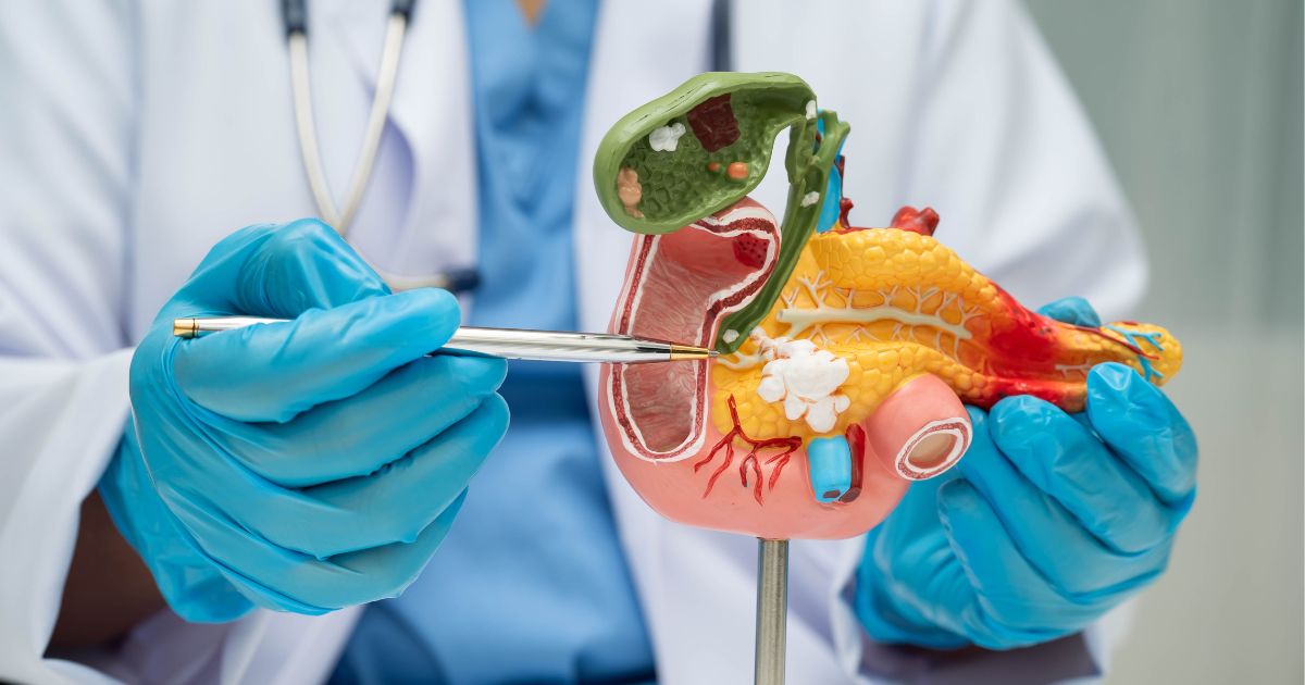 ผ่าตัดตับอ่อน (Pancreatectomy) ขั้นตอน ข้อดี พักฟื้นกี่วัน - Pancreatectomy: Procedure, Advantages, Recovery