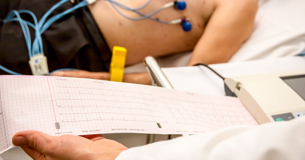 electrocardiography การตรวจคลื่นไฟฟ้าหัวใจ EKG, ECG