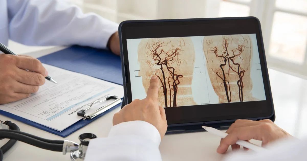 ตรวจหลอดเลือดสมอง ฉีดสีหลอดเลือดสมอง ข้อบ่งชี้ ขั้นตอน ข้อดี - Cerebral Angiogram: Signs, Symptoms, Procedure, Benefits