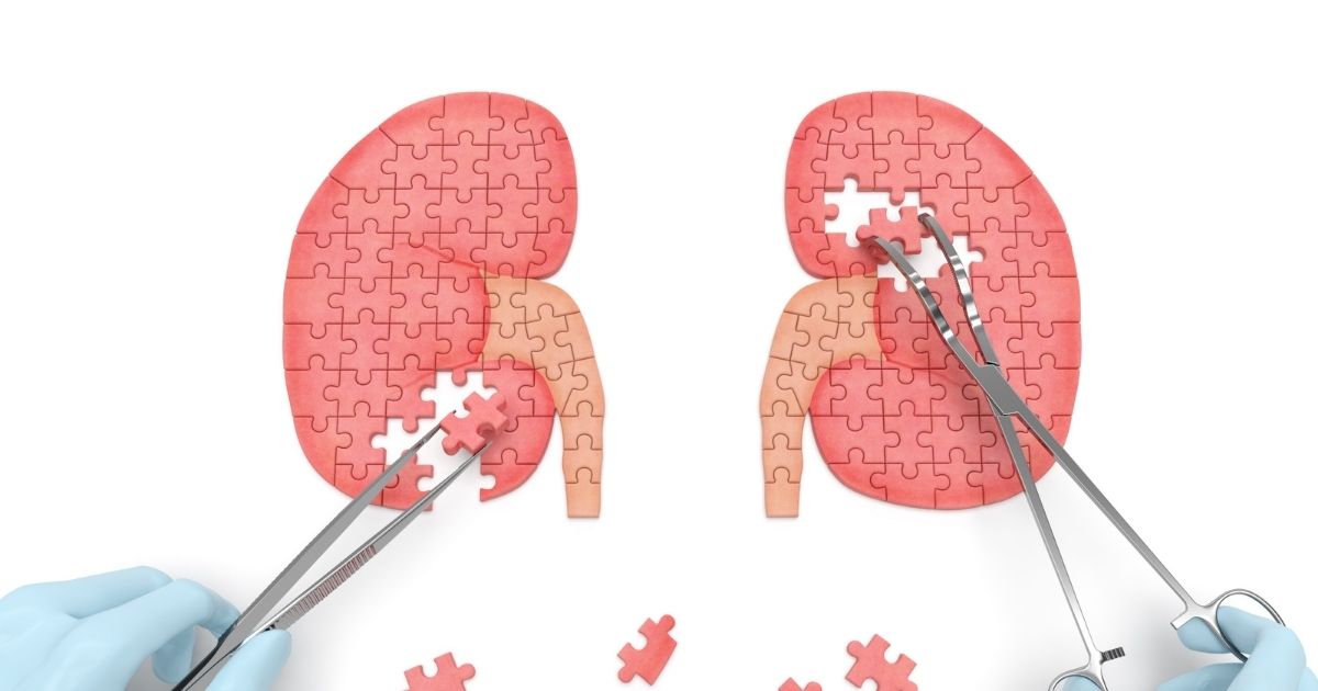 เนื้องอกที่ไต (Kidney Tumors) อาการ สาเหตุ การตรวจวินิจฉัยและการรักษา