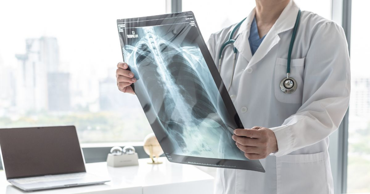 อาการ สาเหตุ การรักษาพังผืดในปอด - Pulmonary Fibrosis: Symptoms, Causes and Treatment