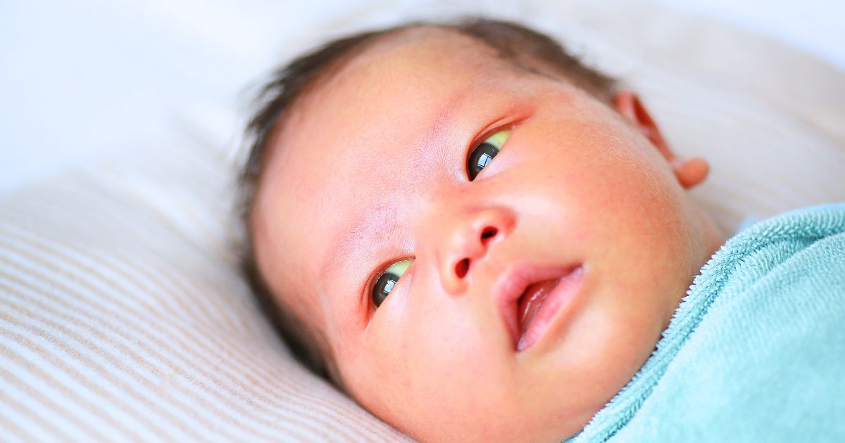 Jaundice in Newborns Banner