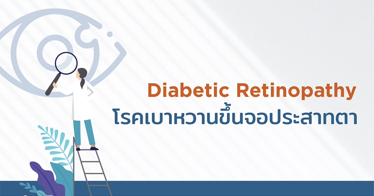 อาการ การวินิจฉัย และการรักษาโรคเบาหวานขึ้นตา - Diabetic Retinopathy: Symptoms, Diagnosis and Treatment