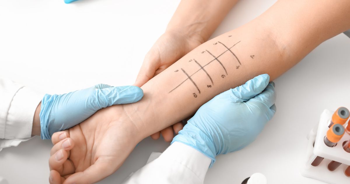 ทดสอบภูมิแพ้ทางผิวหนัง (Skin Prick Test) ขั้นตอน ข้อดี กี่วันรู้ผล - Skin prick test: Procedure, Benefits, Turnaround time