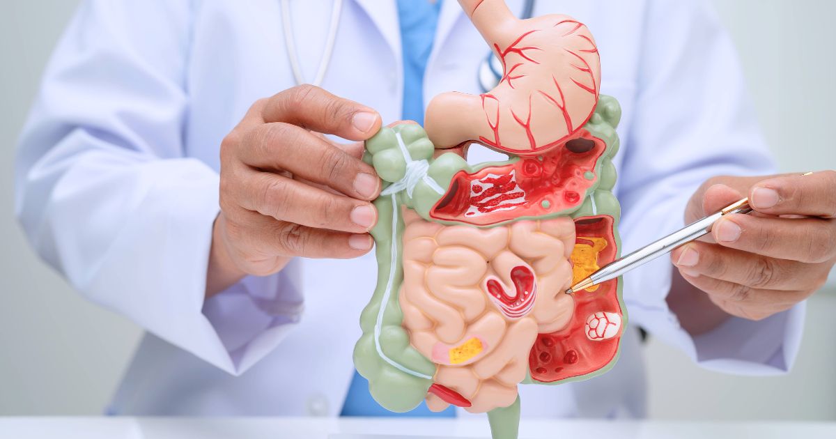 ตรวจจุลินทรีย์ใน ลำไส้ หาสาเหตุสิวเรื้อรัง ท้องผูก โรคอ้วน และอื่น ๆ - Gut Microbiome Test: Finds Chronic Disease, Benefits