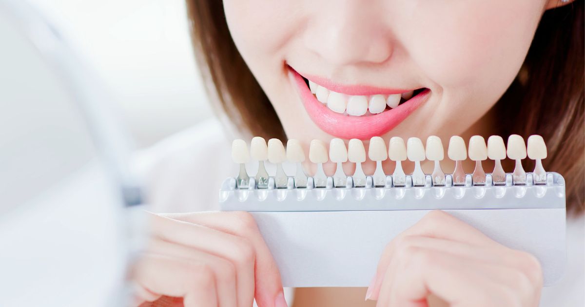 ฟอกสีฟัน ฟอกฟันขาว ฟันเหลือง ฟันดำ ขั้นตอนการทำ ราคาเท่าไหร่ - Teeth Whitening Treatment, Yellow teeth, Black teeth, Procedures, Fees