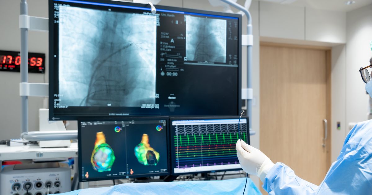 การขยายหลอดเลือดหัวใจด้วยบอลลูนและขดลวด (PCI) ทำเพื่ออะไร? - Percutaneous coronary intervention 