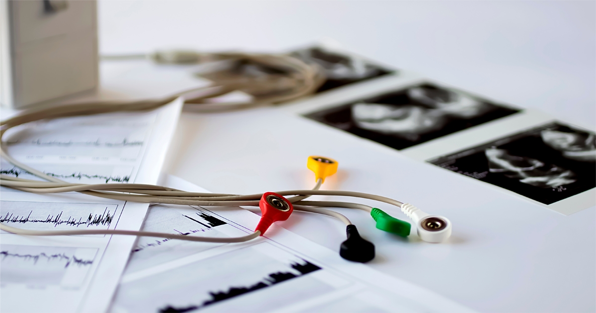 Holter monitor เครื่องบันทึกคลื่นไฟฟ้าหัวใจ 24 ชั่วโมง